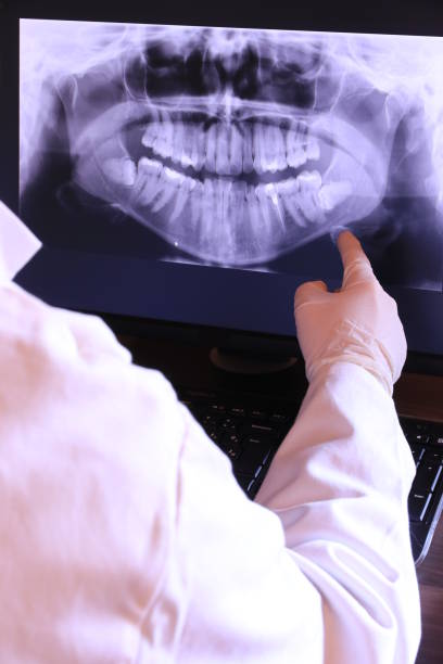 Best Emergency Dentist for Knocked-Out Tooth in Luray, VA