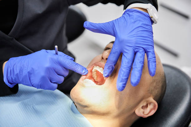 Best Emergency Dentist for Lost Fillings or Crowns in Luray, VA